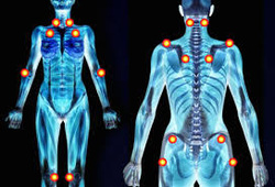 Relief from Fibromyalgia in Easthampton, MA